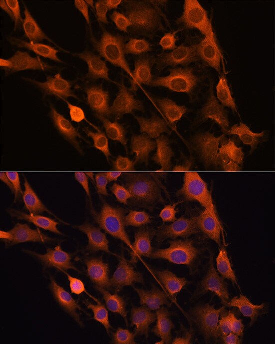 Ribonuclease Inhibitor Antibody