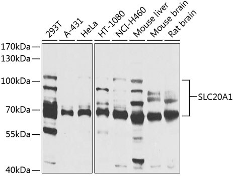 SLC20A1 Antibody