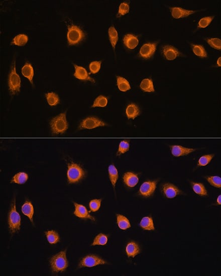 SLC20A1 Antibody