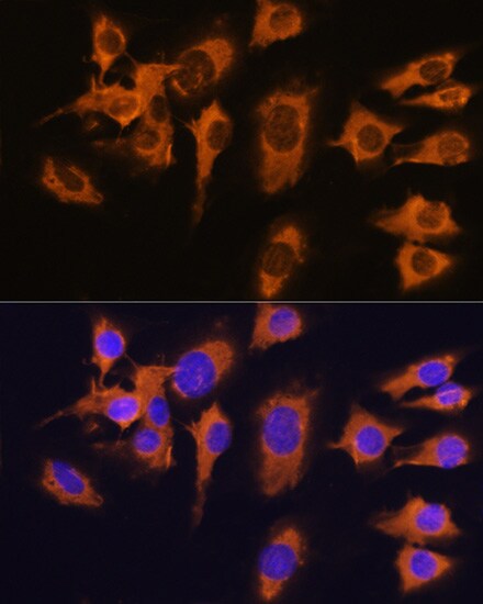 SLC20A1 Antibody