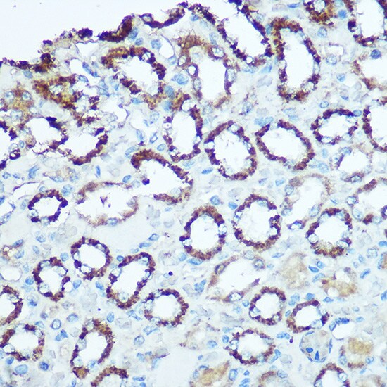 UQCRC2 Antibody