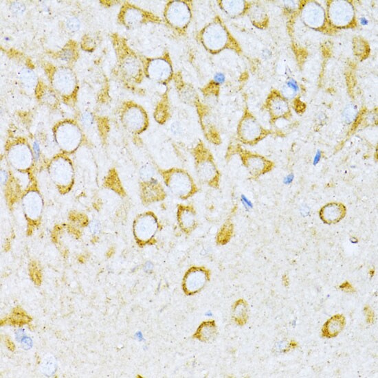 VARS Antibody