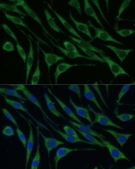 VARS Antibody