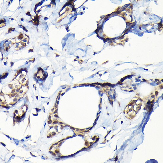 Isopeptidase T/USP5 Antibody