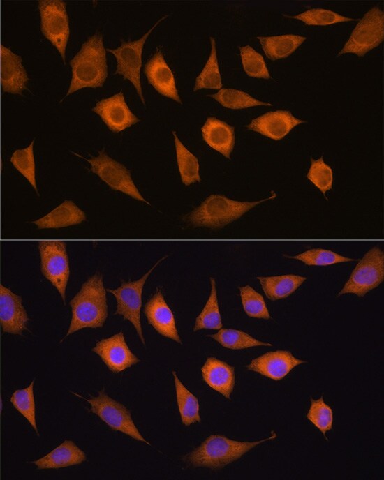 Isopeptidase T/USP5 Antibody