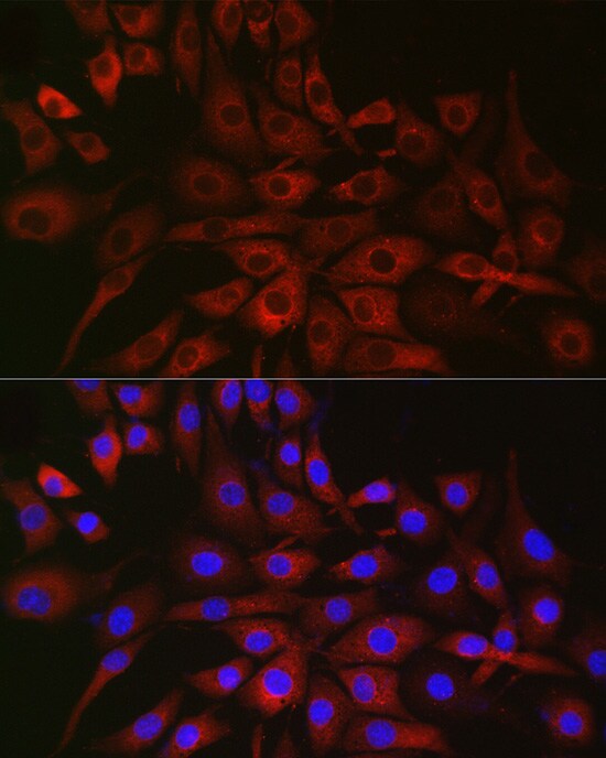 P4HA2 Antibody