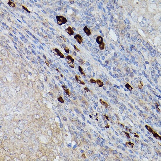 UbcH8/Ube2L6 Antibody
