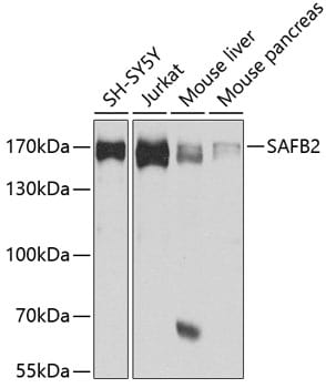 Scaffold attachment factor B2 Antibody