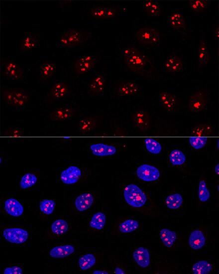 MYBBP1A Antibody