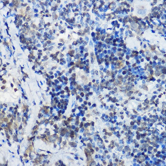 MYBBP1A Antibody