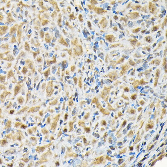 RBBP9 Antibody