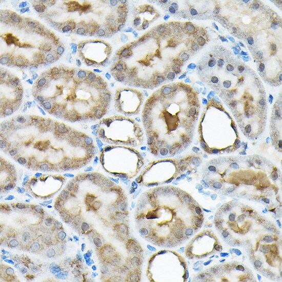 RBBP9 Antibody