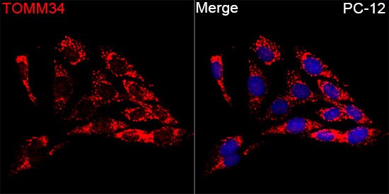 TOMM34 Antibody