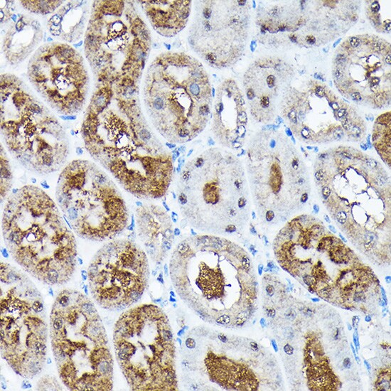 ADRM1 Antibody
