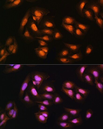 ADRM1 Antibody