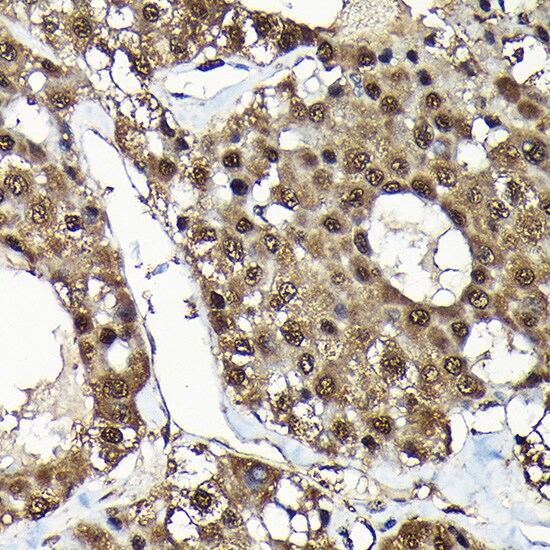 ADRM1 Antibody
