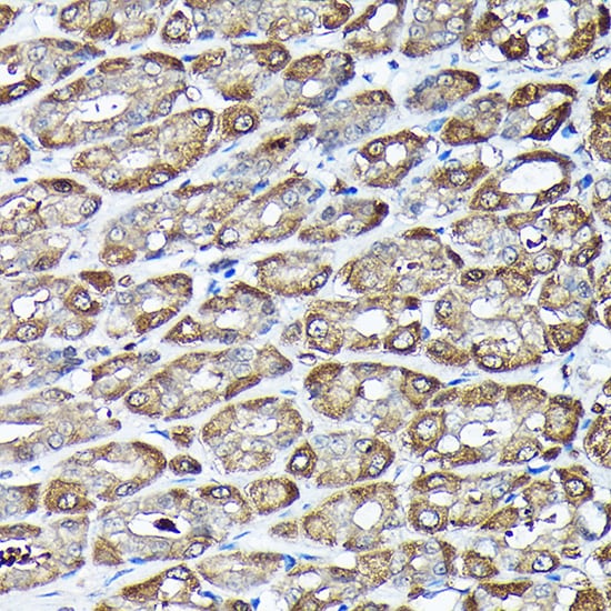 ADRM1 Antibody