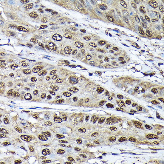 ADRM1 Antibody