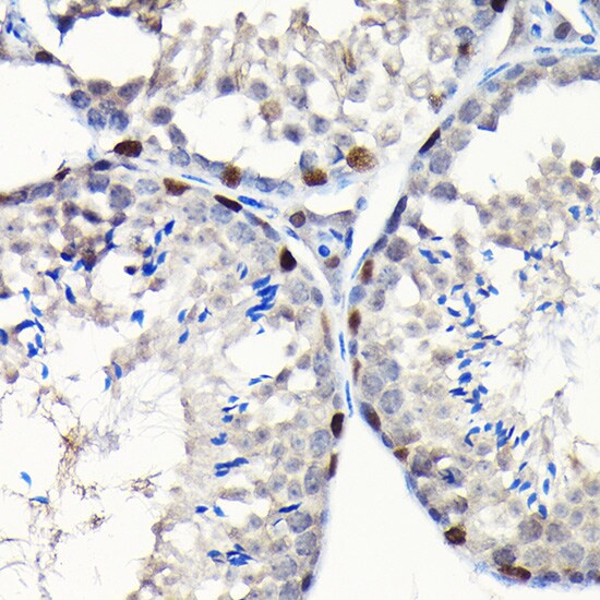 GTPBP4 Antibody