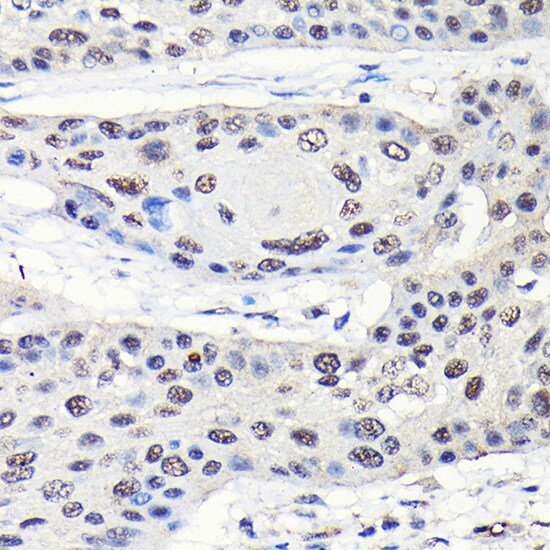 GTPBP4 Antibody