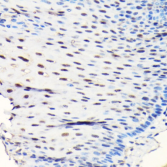 GTPBP4 Antibody