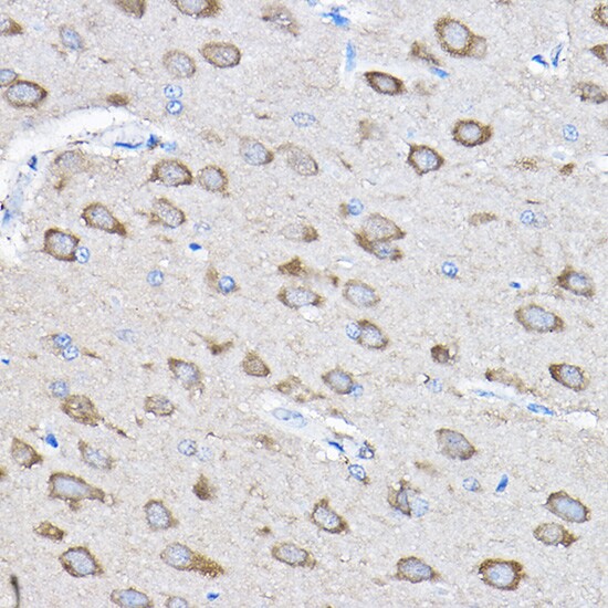 PTPN23 Antibody