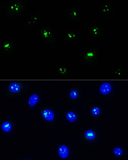 NOP58 Antibody