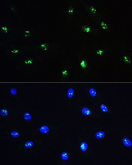 NOP58 Antibody