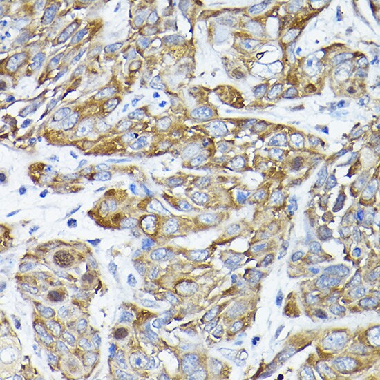 CC2D1A Antibody