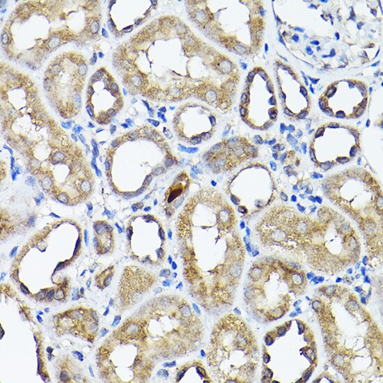 CC2D1A Antibody