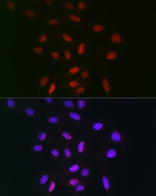 TDP1 Antibody