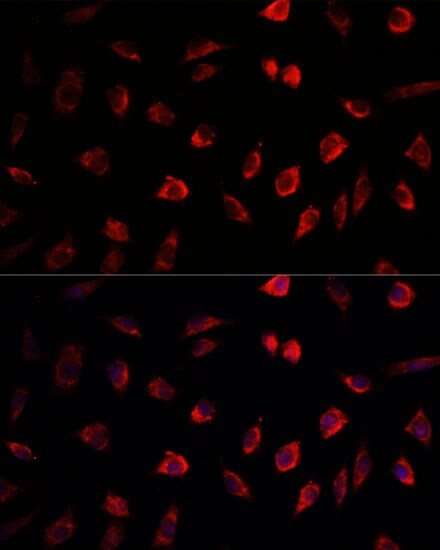 NEDD1 Antibody