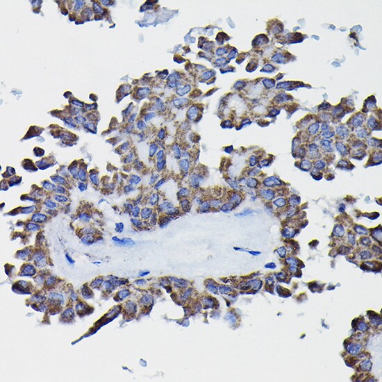 Glutathione S Transferase kappa 1 Antibody