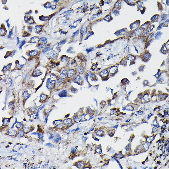 Glutathione S Transferase kappa 1 Antibody
