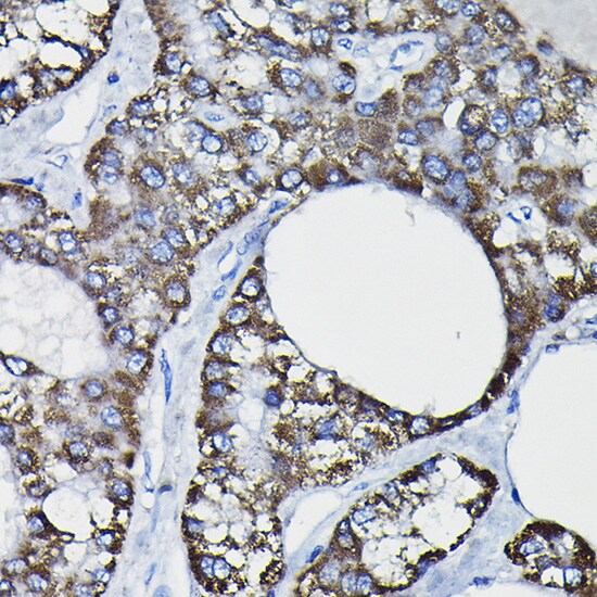 Glutathione S Transferase kappa 1 Antibody