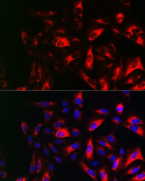 RRM2 Antibody