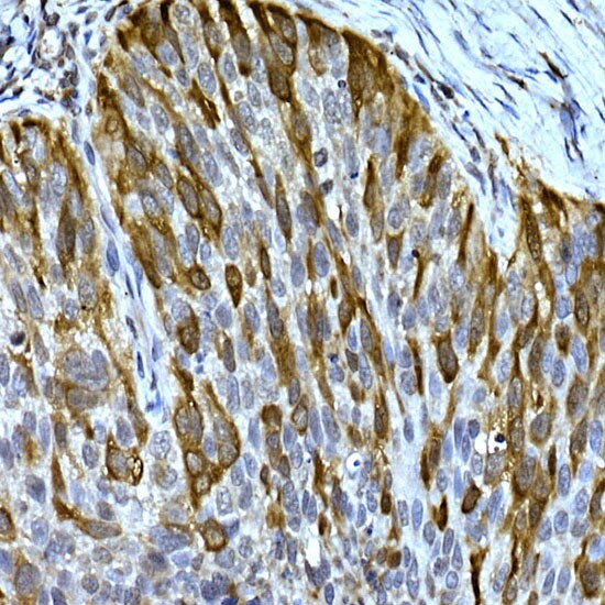 RRM2 Antibody
