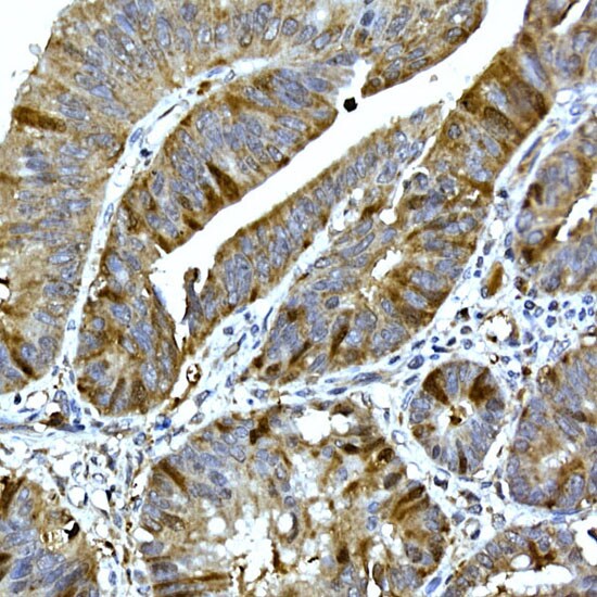 RRM2 Antibody