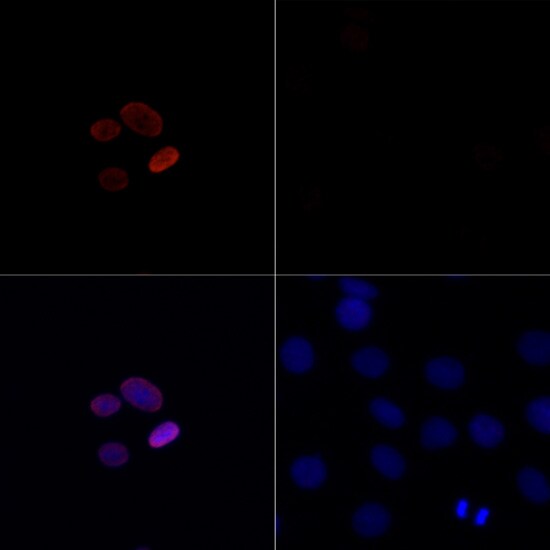 H4 Clustered Histone 1 [ac Lys16] Antibody