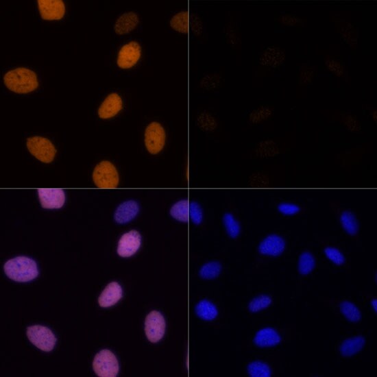 H4 Clustered Histone 1 [ac Lys16] Antibody