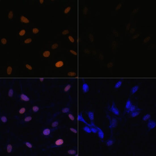 H4 Clustered Histone 1 [ac Lys16] Antibody