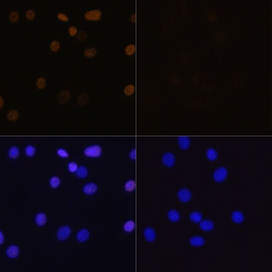 H4 Clustered Histone 1 [ac Lys16] Antibody