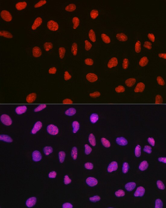 NONO Antibody