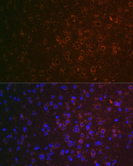 ABAT Antibody