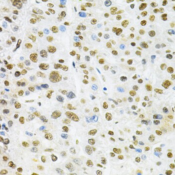 BAF57 Antibody