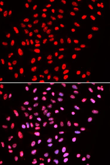 BAF57 Antibody
