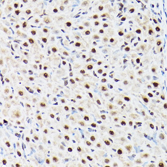BAF53A Antibody