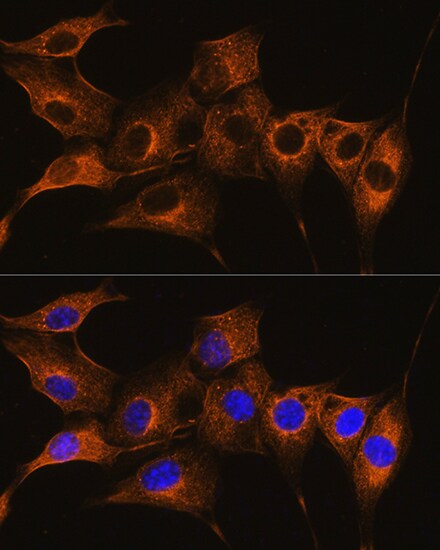 Complement C7 Antibody