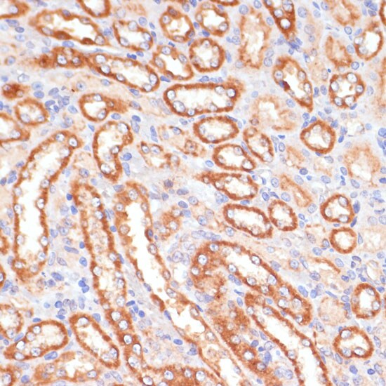 Cytochrome b5 type A Antibody