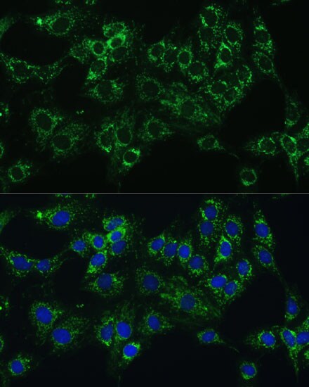 Cytochrome b5 type A Antibody